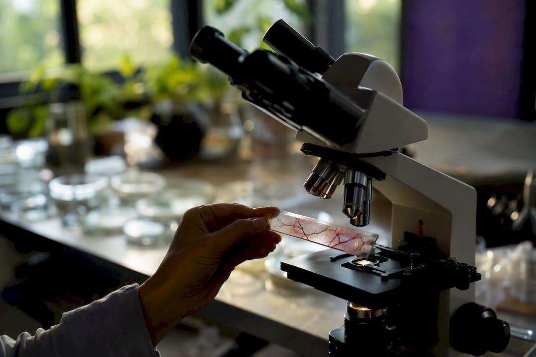Microscope slide showing new blood vessel growth